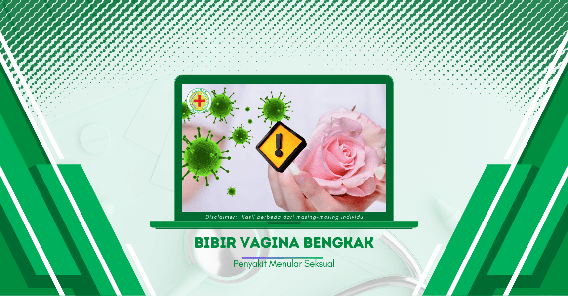 Bibir Vagina Bengkak, Kenapa Bisa Terjadi? Begini Cara Mengobatinya