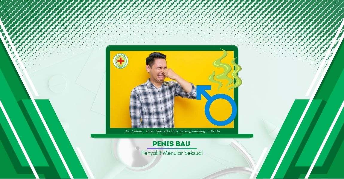 Penyebab Penis Bau dan Dampak Psikologis pada Penderitanya