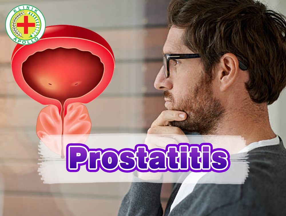 prostatitis (4)
