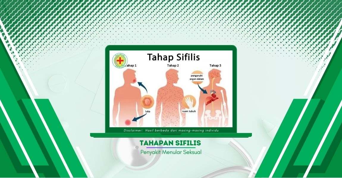 4 Tahapan Sifilis dan Gejalanya, Mana yang Paling Berbahaya?
