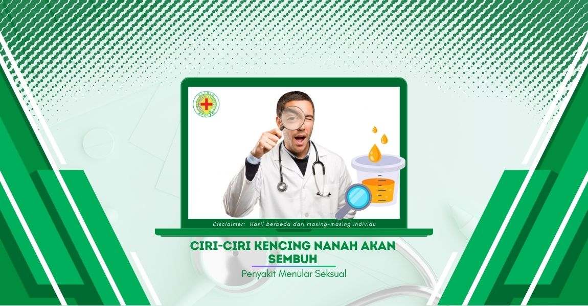 Ciri-Ciri Kencing Nanah akan Sembuh, Penderita Wajib Tahu!