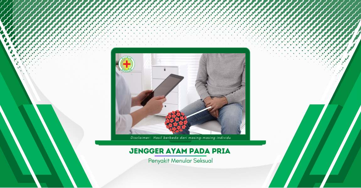 Jengger Ayam pada Pria: Gejala hingga Pencegahan