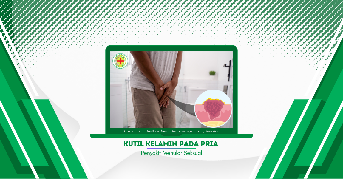 Kutil Kelamin pada Pria