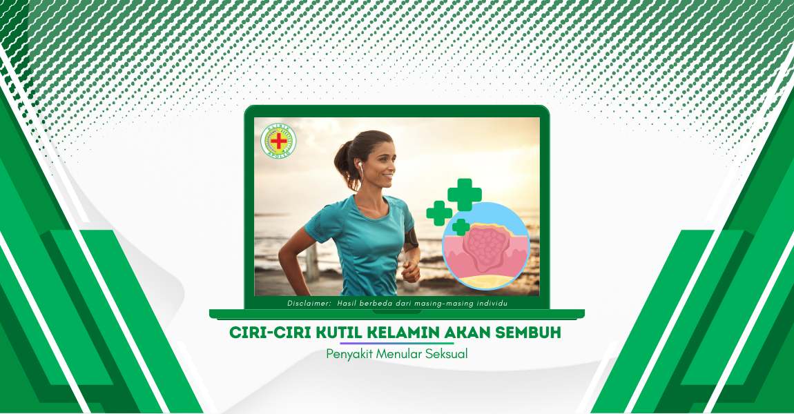 Informasi Penting: Inilah Ciri-Ciri Kutil Kelamin Akan Sembuh