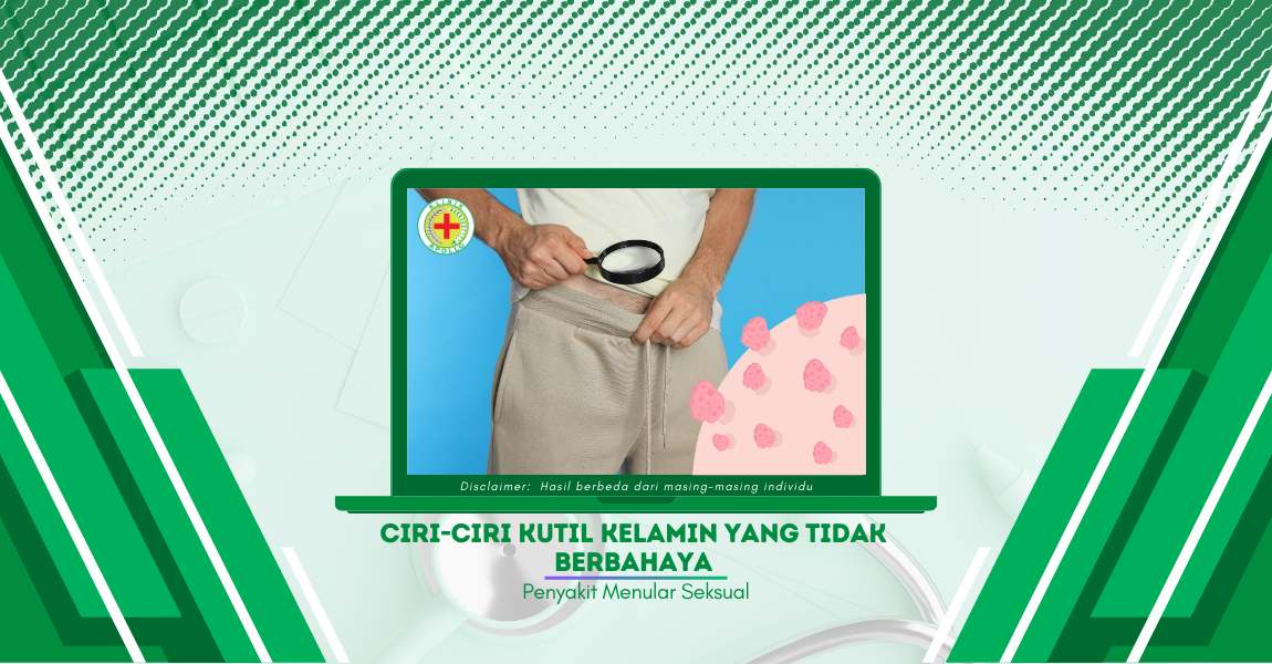 Begini Ciri-Ciri Kutil Kelamin yang Tidak Berbahaya