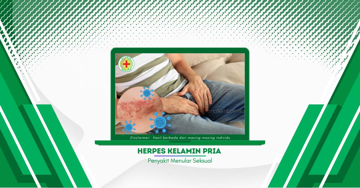 Waspada, Herpes Kelamin Pria Bisa Berdampak pada Psikologis