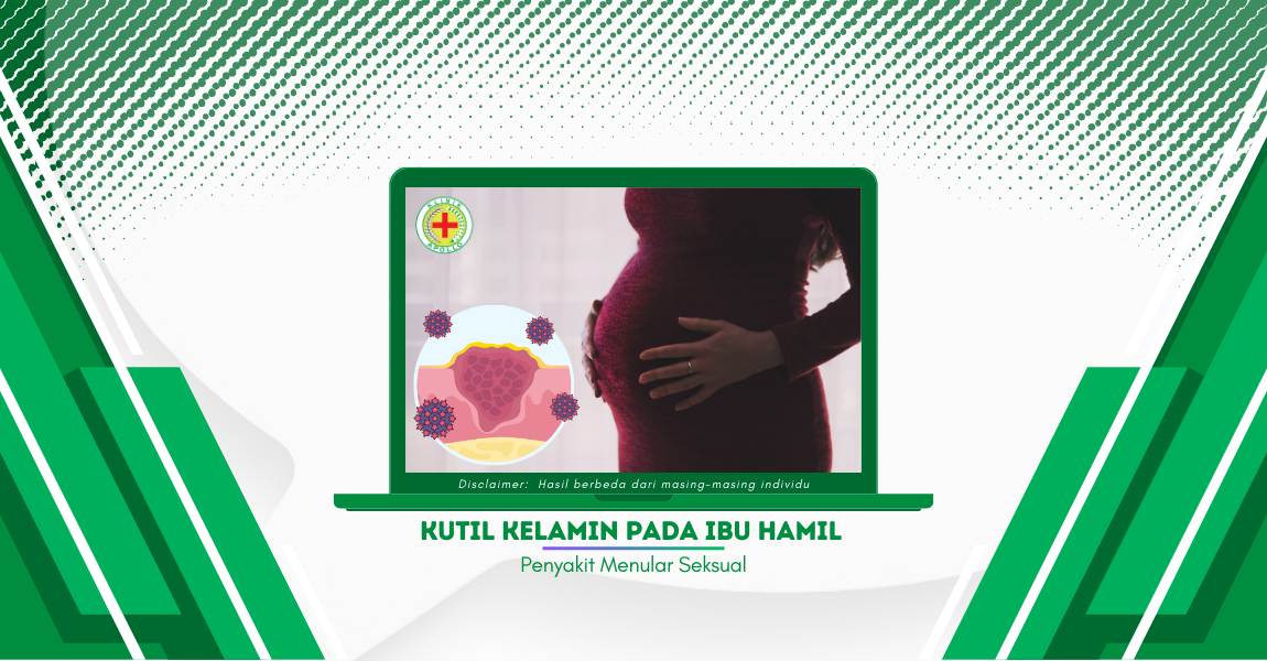 Mengupas Informasi Kutil Kelamin pada Ibu Hamil