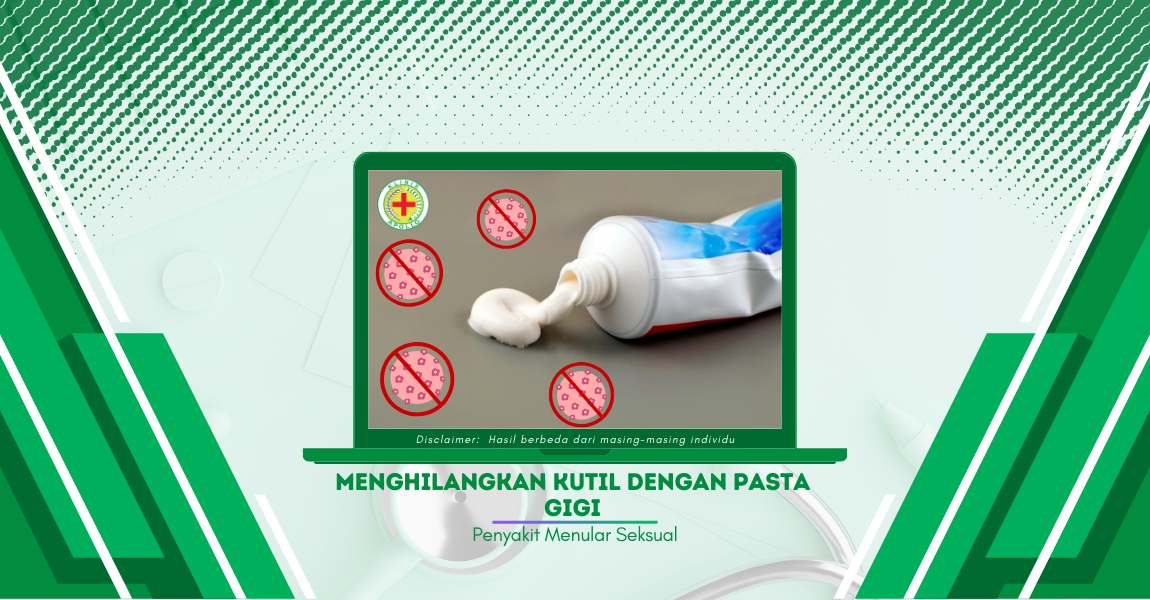 Menghilangkan Kutil dengan Pasta Gigi, Apakah Bisa?
