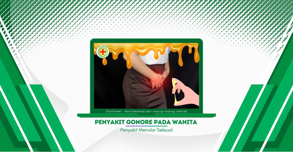 Serba-serbi Hal Penting Terkait Penyakit Gonore pada Wanita