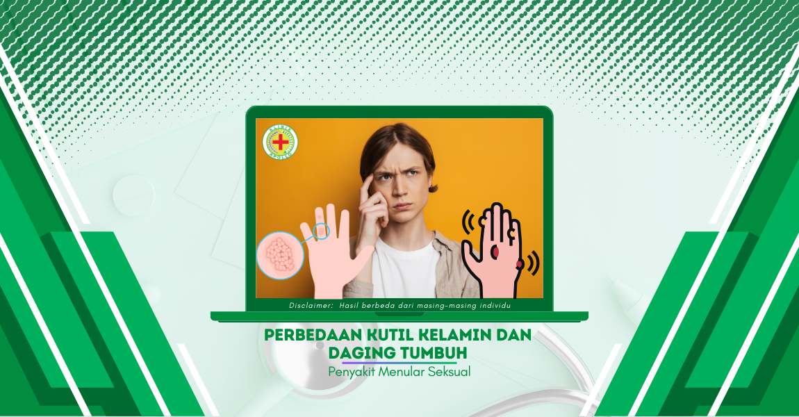 Perbedaan Kutil Kelamin dan Daging Tumbuh