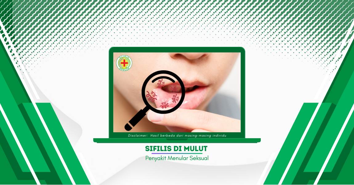 Sifilis di Mulut Bisa Merusak Organ Dalam, Berikut Informasinya