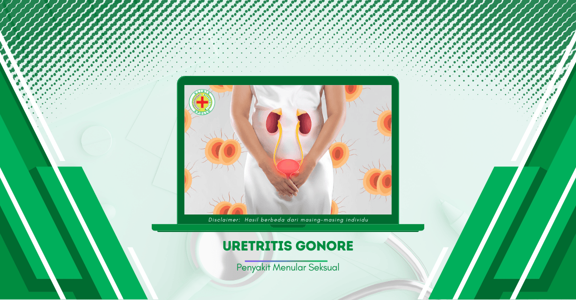 Mengenal Uretritis Gonore: Pengertian hingga Pencegahan