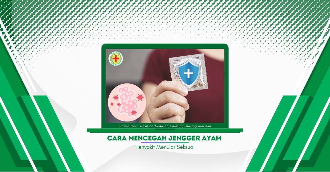 Panduan: Cara Mencegah Jengger Ayam (Kutil Kelamin)