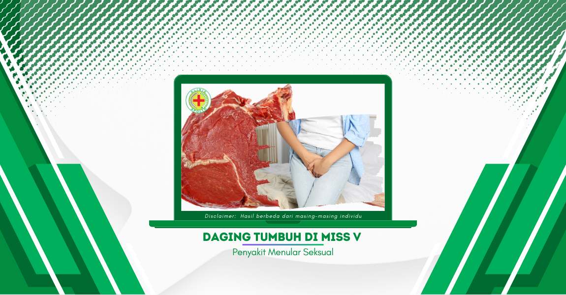 Hati-Hati dengan Daging yang Tumbuh di Miss V, Ini yang Terjadi