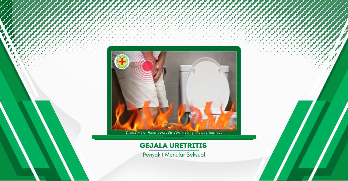 Inilah Sejumlah Gejala Uretritis: Bukan Cuma Nyeri