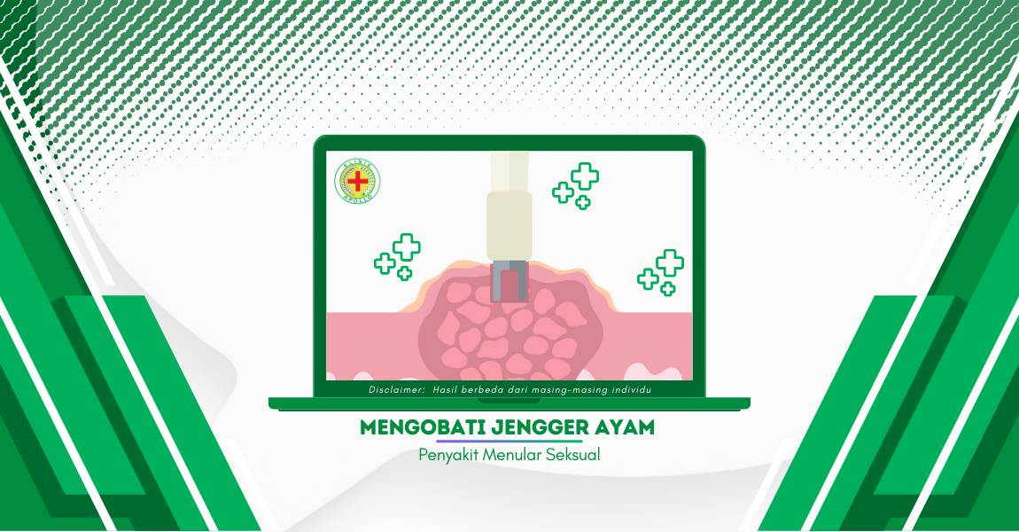 Mengobati Jengger Ayam Sangat Penting, Begini Caranya
