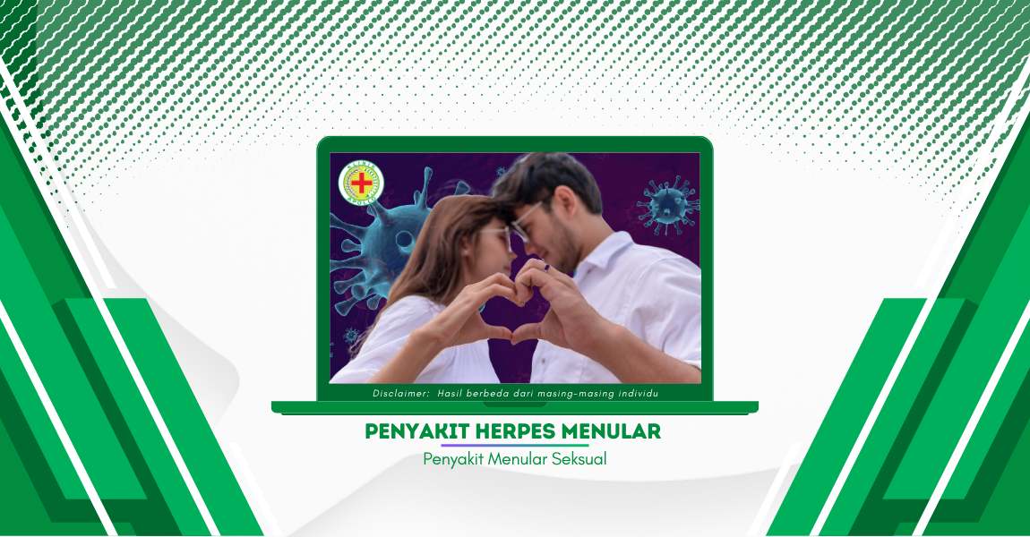 Apakah Infeksi dari Penyakit Herpes Menular? Ini Jawabannya