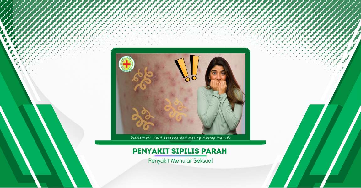 engerikan! Seperti Inilah Ciri-Ciri Penyakit Sipilis Parah