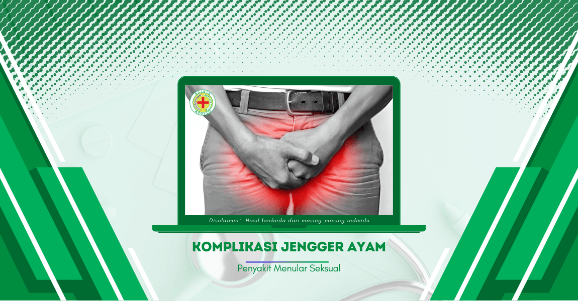 Jangan Lakukan Ini jika Tak ingin Derita Komplikasi Jengger Ayam