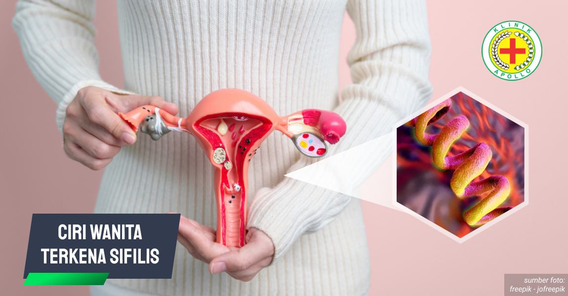 Ciri Wanita Terkena Sifilis