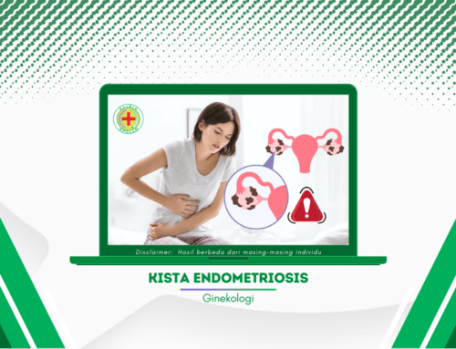 Ketahui 5 Ciri Kista Endometriosis, Dan Begini Penanganannya