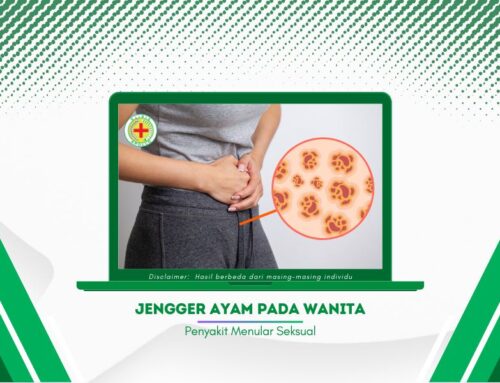 Intip! 7 Penyebab Jengger Ayam pada Wanita, Ini Penanganannya