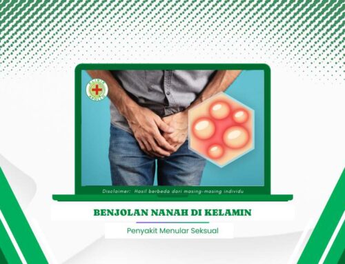 Waspada! Benjolan Nanah di Kelamin Bahaya Tanpa Pengobatan