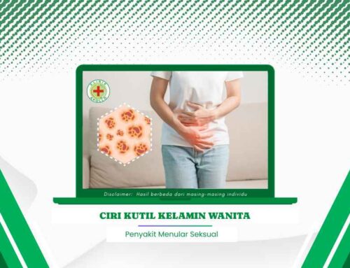 Jangan Anggap Sepele! Inilah Ciri Kutil Kelamin Wanita yang Parah