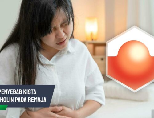 Kenali 5 Penyebab Kista Bartholin Remaja Berikut Penanganannya