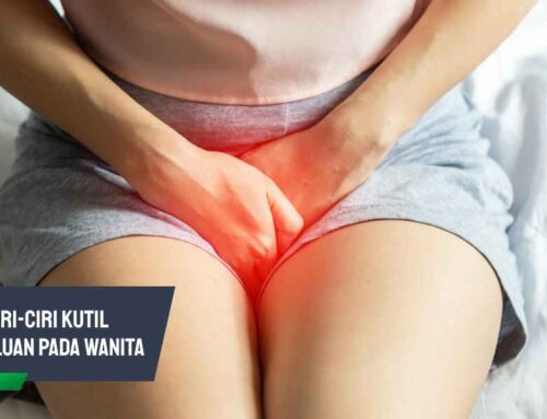 7 Ciri-ciri Kutil Kemaluan pada Wanita dan Penanganannya