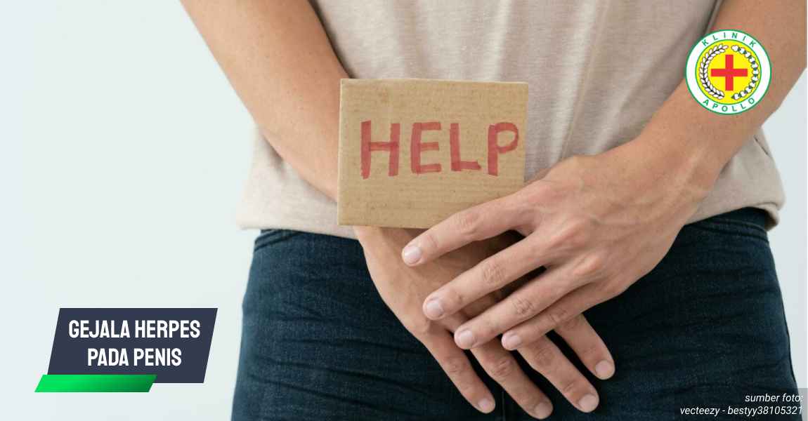 Ilustrasi Gejala Herpes pada Penis.