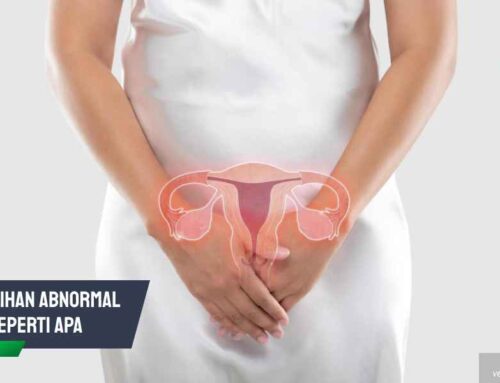 Simak! Ciri dan Tanda Keputihan Abnormal Seperti Apa?