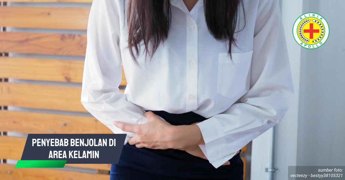 Ilustrasi Penyebab Benjolan di Area Kelamin.