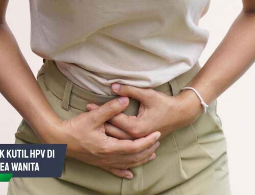 Ketahui, Bentuk Kutil HPV di Area Wanita dan Penanganannya