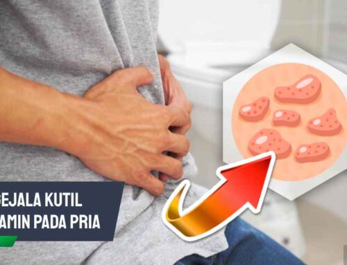 Jangan Abai! Ini Gejala Kutil Kelamin pada Pria Perlu Waspada