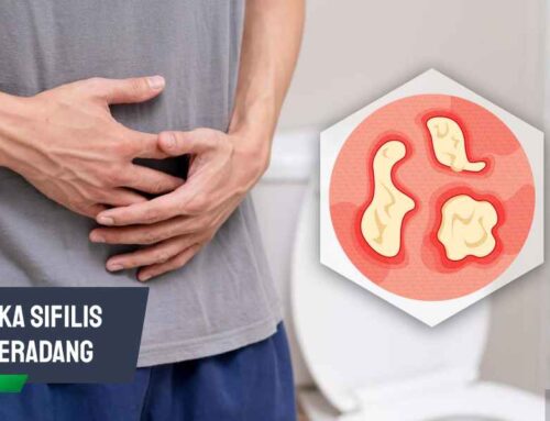 Kenali Tanda Luka Sifilis Meradang dan Cara Mengobatinya