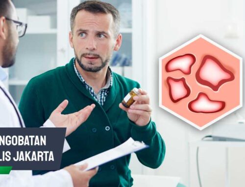 Pengobatan Sifilis Jakarta: Solusi untuk Atasi Infeksi Menular