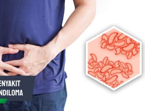 Kenali Penyakit Kondiloma dan Bahayanya Jika Tidak Diobati