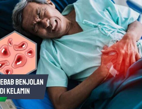 Waspadai! Ini Penyebab Benjolan di Kelamin yang Sering Terjadi