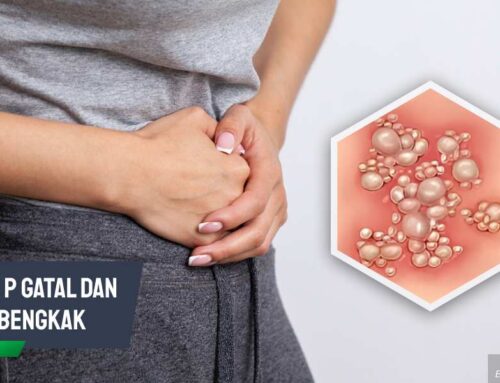 Jangan Dibiarkan! Mr. P Gatal dan Bengkak Sebabkan Komplikasi