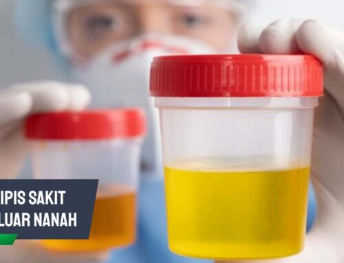 Pipis Sakit Keluar Nanah? Bisa Jadi Tanda Infeksi Menular!