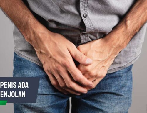 Cara Mengatasi Jika di Penis Ada Benjolan dan Pencegahannya