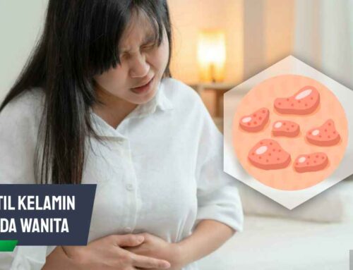 Kutil Kelamin pada Wanita: Penyebab, Gejala, Pengobatannya