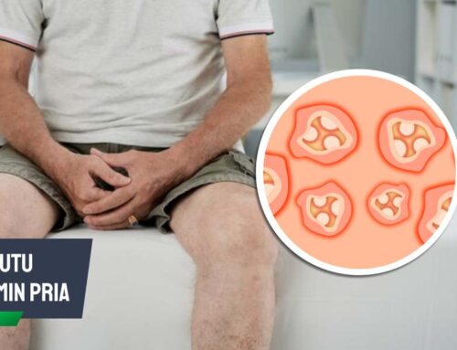 Kutu Kelamin Pria: Solusi Medis untuk Atasi Gatal dan Infeksi