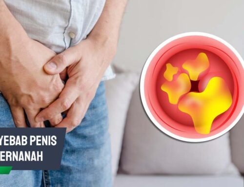 Kenali Penyebab Penis Bernanah dan Cara Mengatasinya