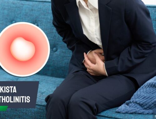 Bahaya Kista Bartholinitis Bila Tak Diobati: Risiko Infeksi & Abses