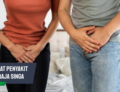 Obat Penyakit Raja Singa: Pilihan Pengobatan Tepat dan Aman