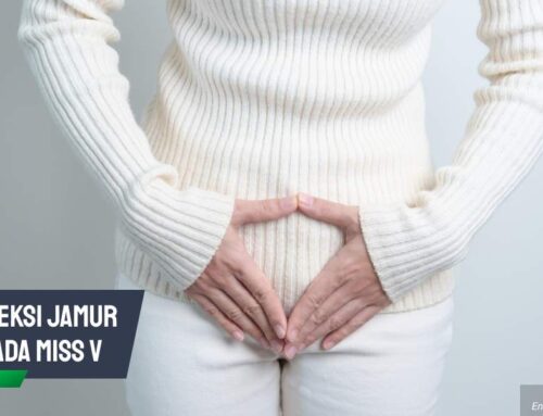 Infeksi Jamur pada Miss V: Kenali Tanda Sebelum Makin Parah