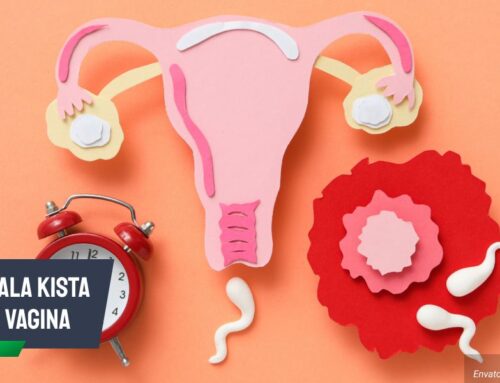 Gejala Kista di Vagina dan Cara Penanganannya Secara Tepat