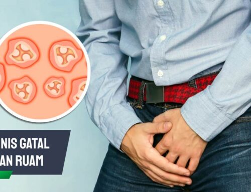 Kenali Penyebab Penis Gatal dan Ruam & Cara Mengatasinya
